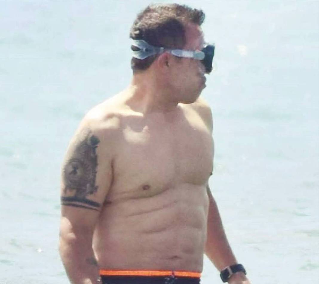 Öyle bir yerine estetik yaptırmış ki anında ortaya çıktı, ilk bakışta şak diye anlaşılıyor! Mustafa Sandal fena yakalandı 4